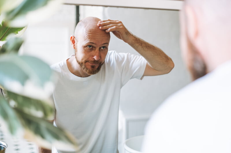 Can Testosterone Boosters Cause Hair Loss? - The Bald Truth 6