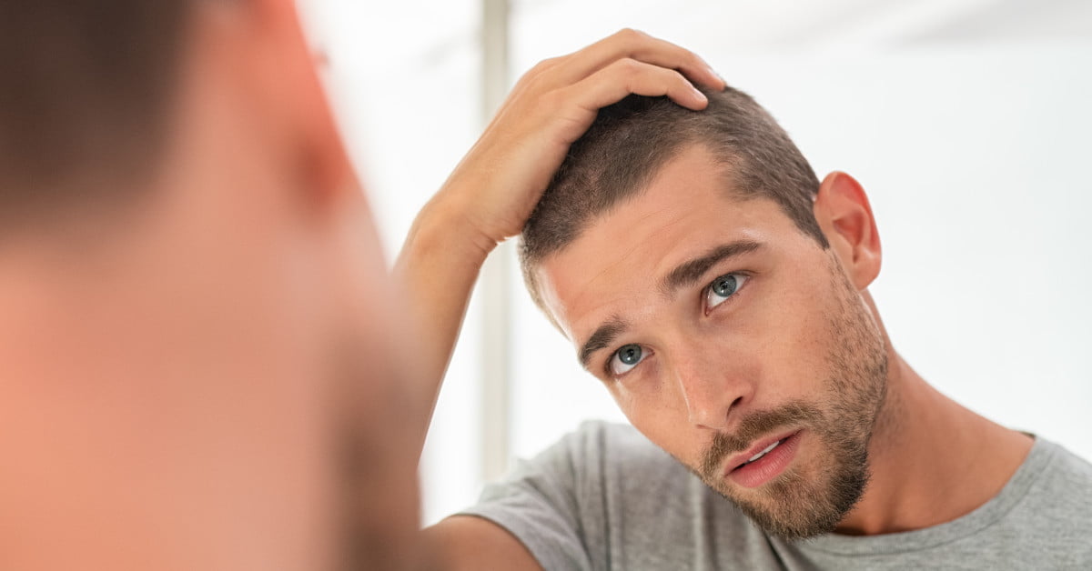 Can Testosterone Boosters Cause Hair Loss? - The Bald Truth 13